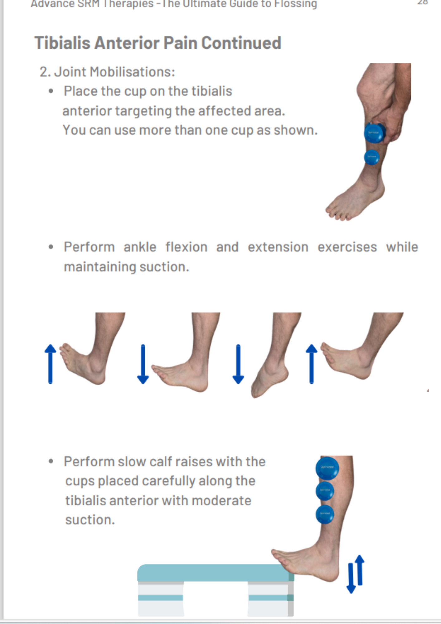 The Ultimate Guide to Active Cupping Therapy